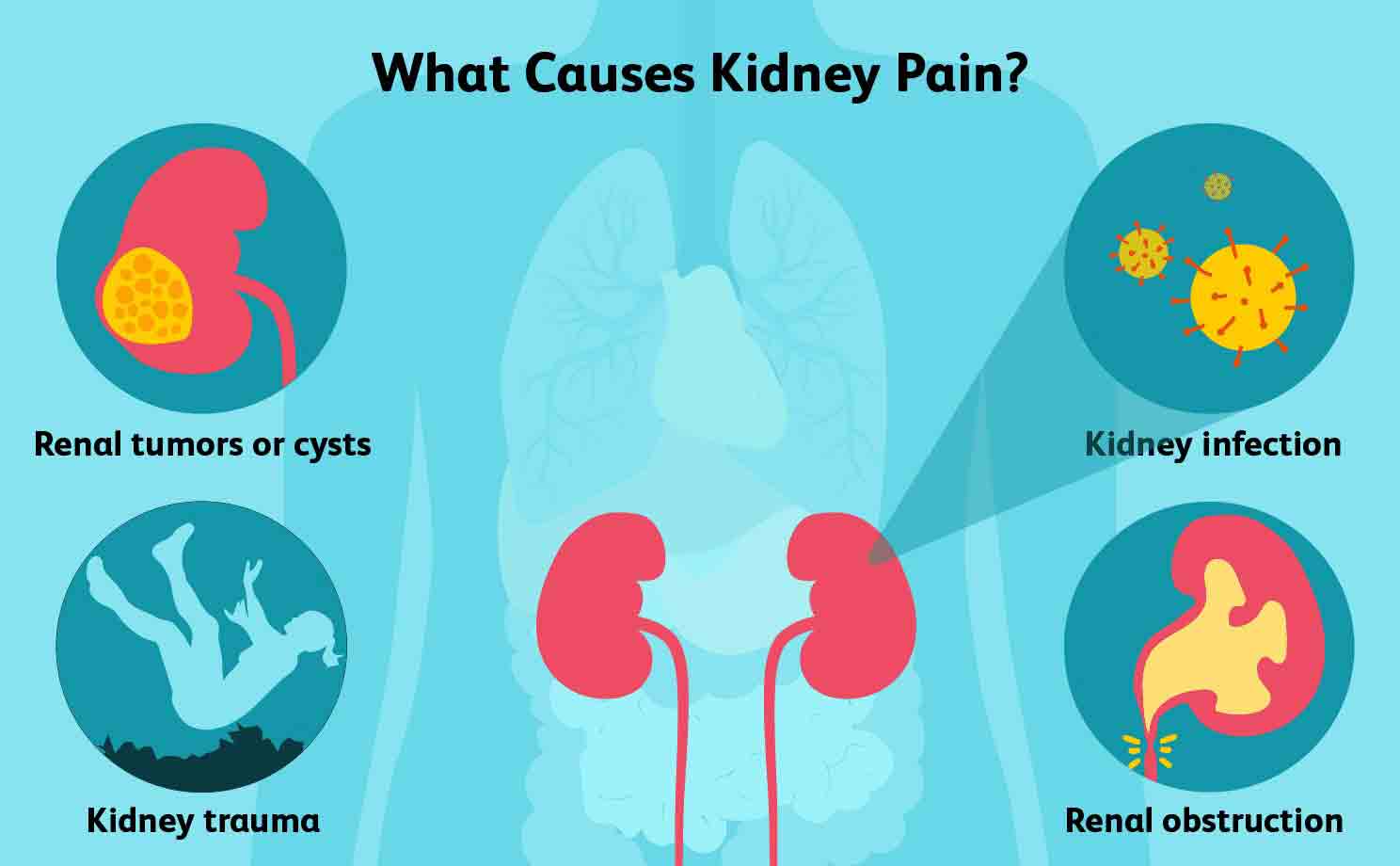 What are the Causes of Kidney Pain?