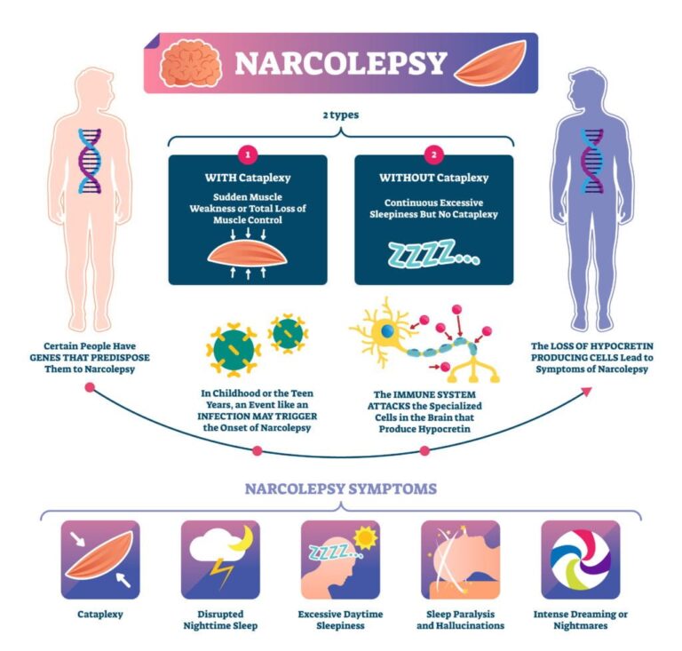 Narcolepsy: A Rare Neurological Disorder