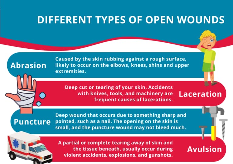 Different Types of Open Wounds