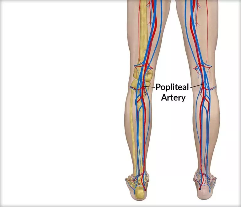 Popliteal Artery Entrapment Syndrome