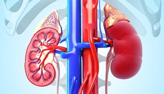 Renal Artery Stenosis