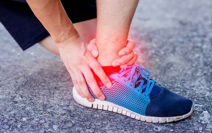 What are Sprains?