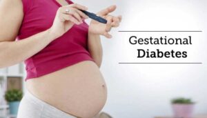 What is Gestational Diabetes?