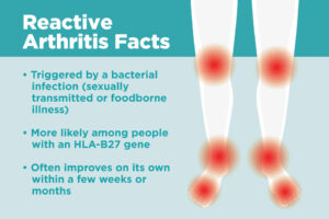 What is Reactive Arthritis?