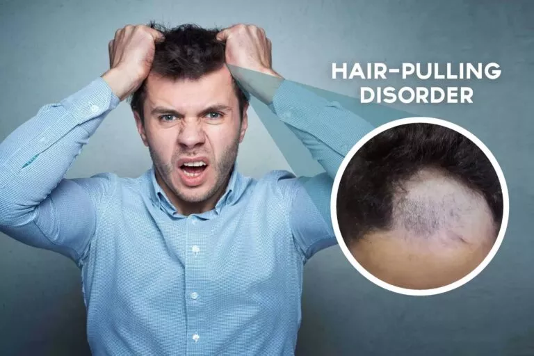 Hair-Pulling Disorder