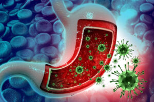 What is Viral Gastroenteritis?