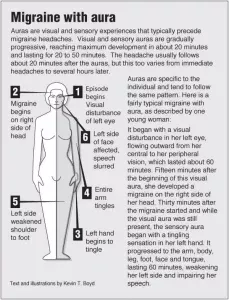 Migraine with Aura