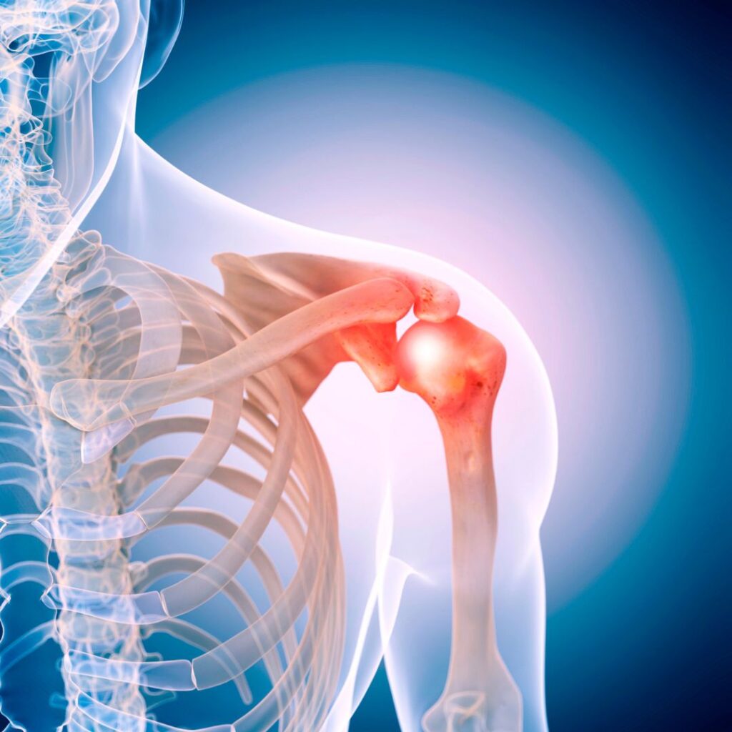 Urgent Care For Treating Acute & Severe Shoulder Pain