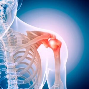 Urgent Care For Treating Acute & Severe Shoulder Pain