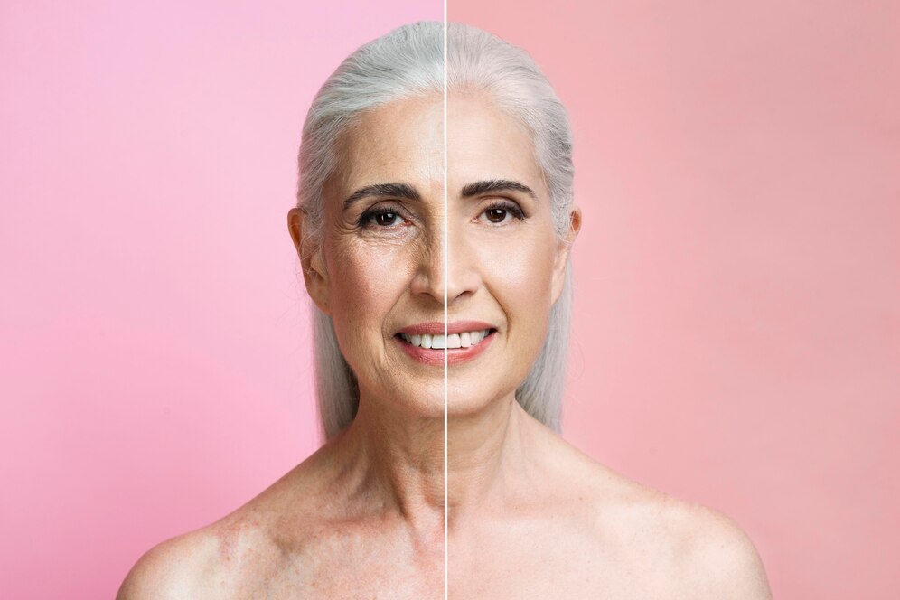 anti-aging
