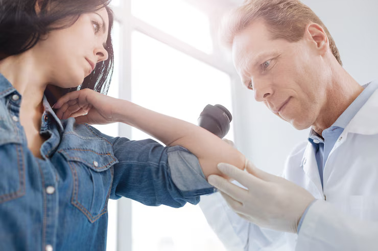 frozen shoulder