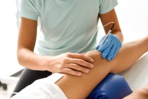 varicose vein treatment