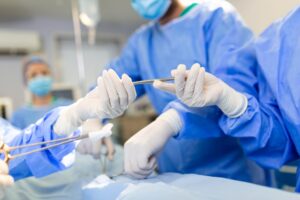 varicose vein surgery