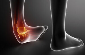 Soft Tissue Injury Treatmen