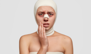 Facial Injury