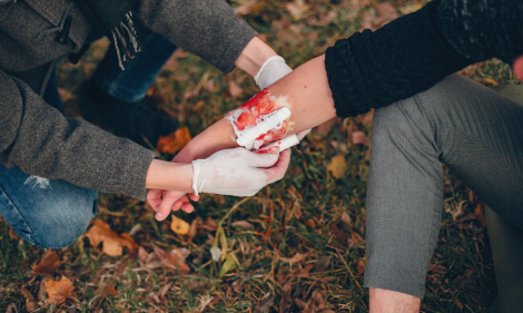 Burns, Cuts, and Scrapes